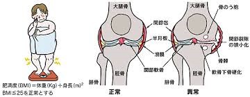 膝関節画像2 膝関節画像2